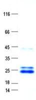 Human NDUFB10 Protein (Recombinant His, N-Terminal)