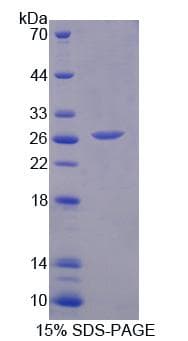 Mouse FAM3B Protein (Recombinant His)