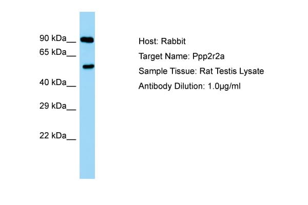 PPP2R2A Antibody (C-Terminus)