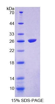 Human FASTK / FAST Protein (Recombinant His-T7)