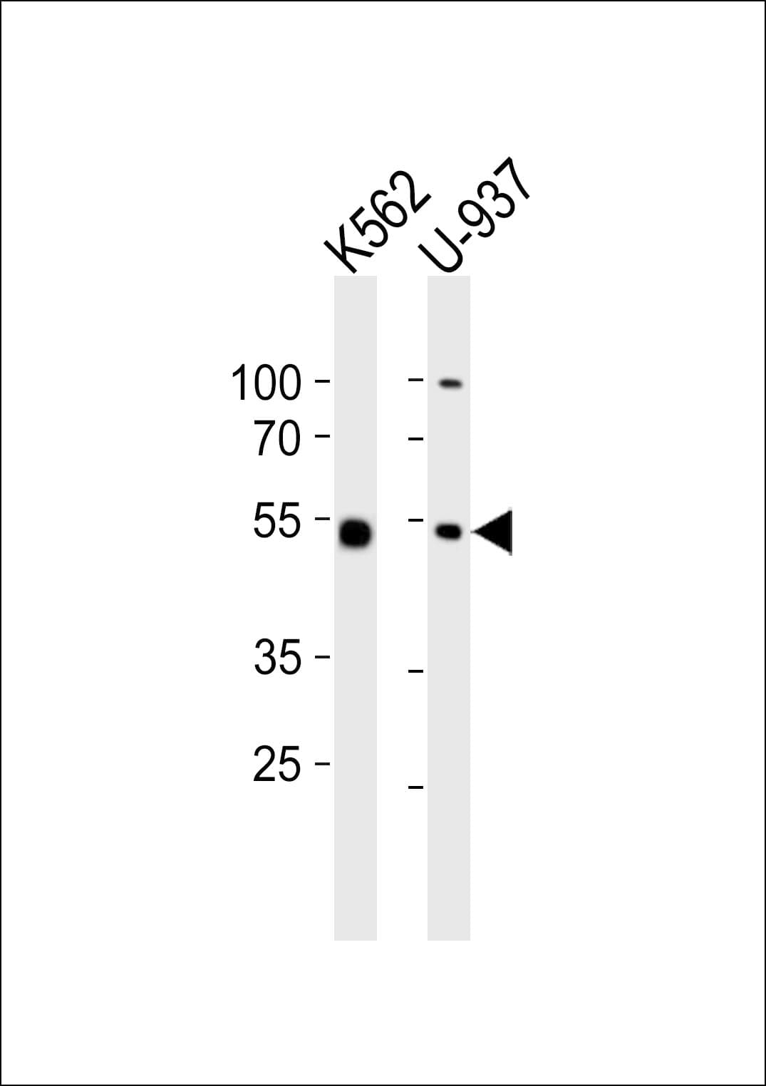 Polyclonal Rabbit anti-Human CDw218a / IL18R1 Antibody (aa527-561, WB)