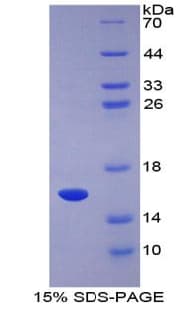 Human FABP4 / AP2 Protein (Recombinant His)