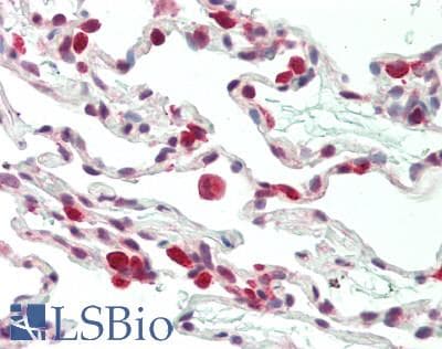 IHC-plus™ TSC22D1 / TSC22 Antibody (aa24-73)
