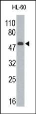 Polyclonal Rabbit anti-Human WT1 / Wilms Tumor 1 Antibody (WB)