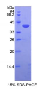 Mouse CCL21 / SLC Protein (Recombinant His-GST)