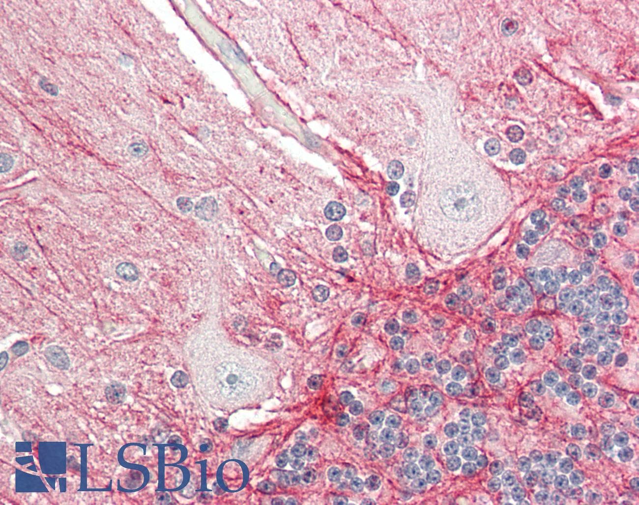 PathPlus™ APP / Beta Amyloid Precursor Antibody (N-Terminus)