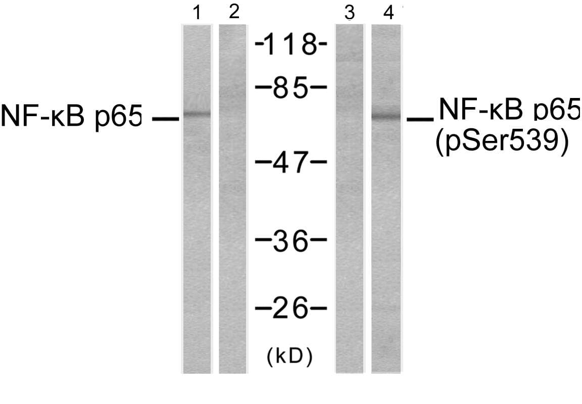 Polyclonal Rabbit anti-Human RELA / NFKB p65 Antibody (phospho-Ser529, IHC, WB)