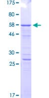 Human CD71 / Transferrin Receptor Protein (Recombinant GST, N-terminus)