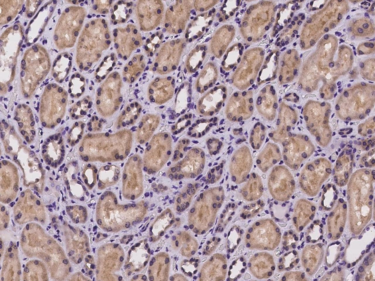 NGLY1 Antibody