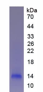 Human FGA / Fibrinogen Alpha Protein (Recombinant His-S)