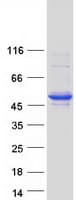 Human SERPINB8 Protein (Recombinant Myc-DDK (Flag))