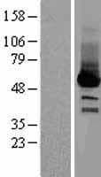 Selenium Binding Protein 1 (Over-Expression Lysate Myc-DDK (Flag))