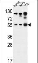 AKT1 Antibody (Ser129)