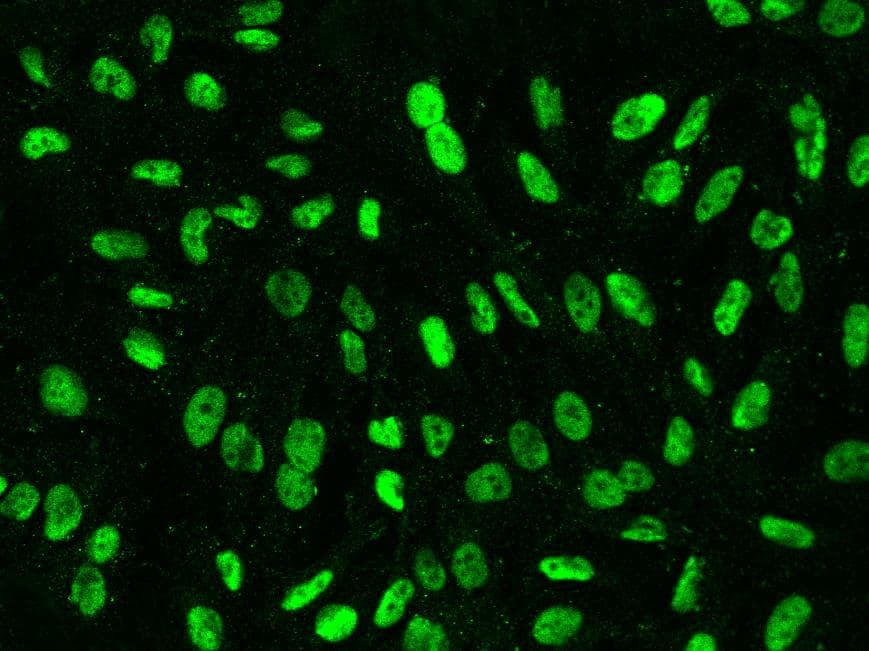 Polyclonal Rabbit anti-Human XRCC1 Antibody (IF, WB)