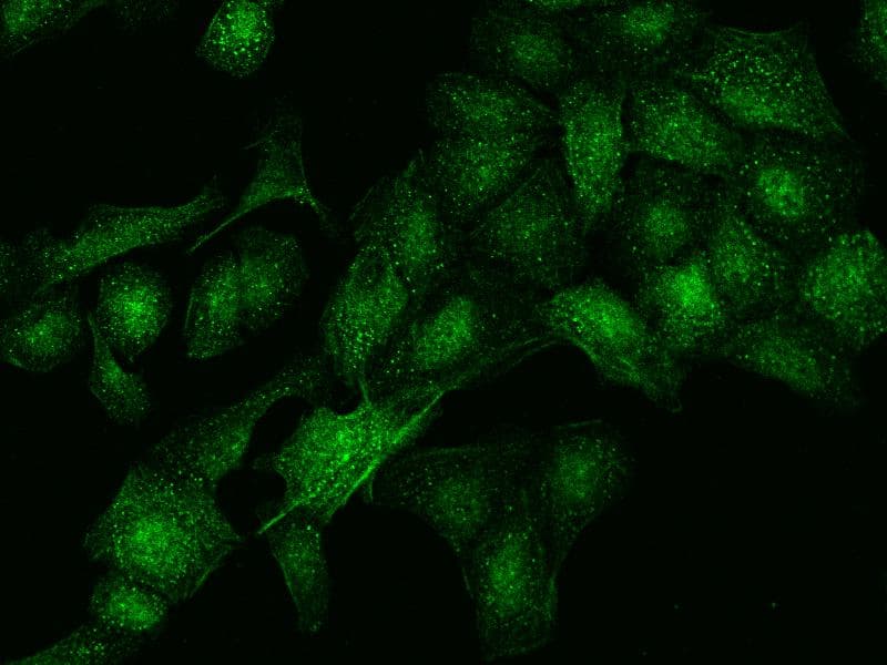DDX59 Antibody