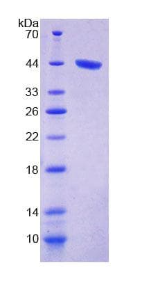 Human PRKCD / PKC-Delta Protein (Recombinant His-T7)
