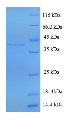 Mouse CTSG / Cathepsin G Protein (Recombinant His-SUMO)
