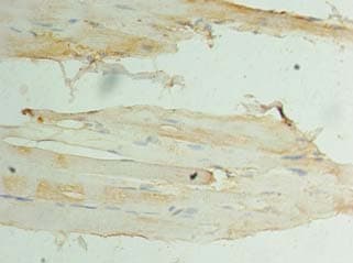 Polyclonal Rabbit anti-Human CSNK1D Antibody (IHC)