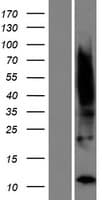 TIMM8B Protein (Over-Expression Lysate Myc-DDK (Flag))