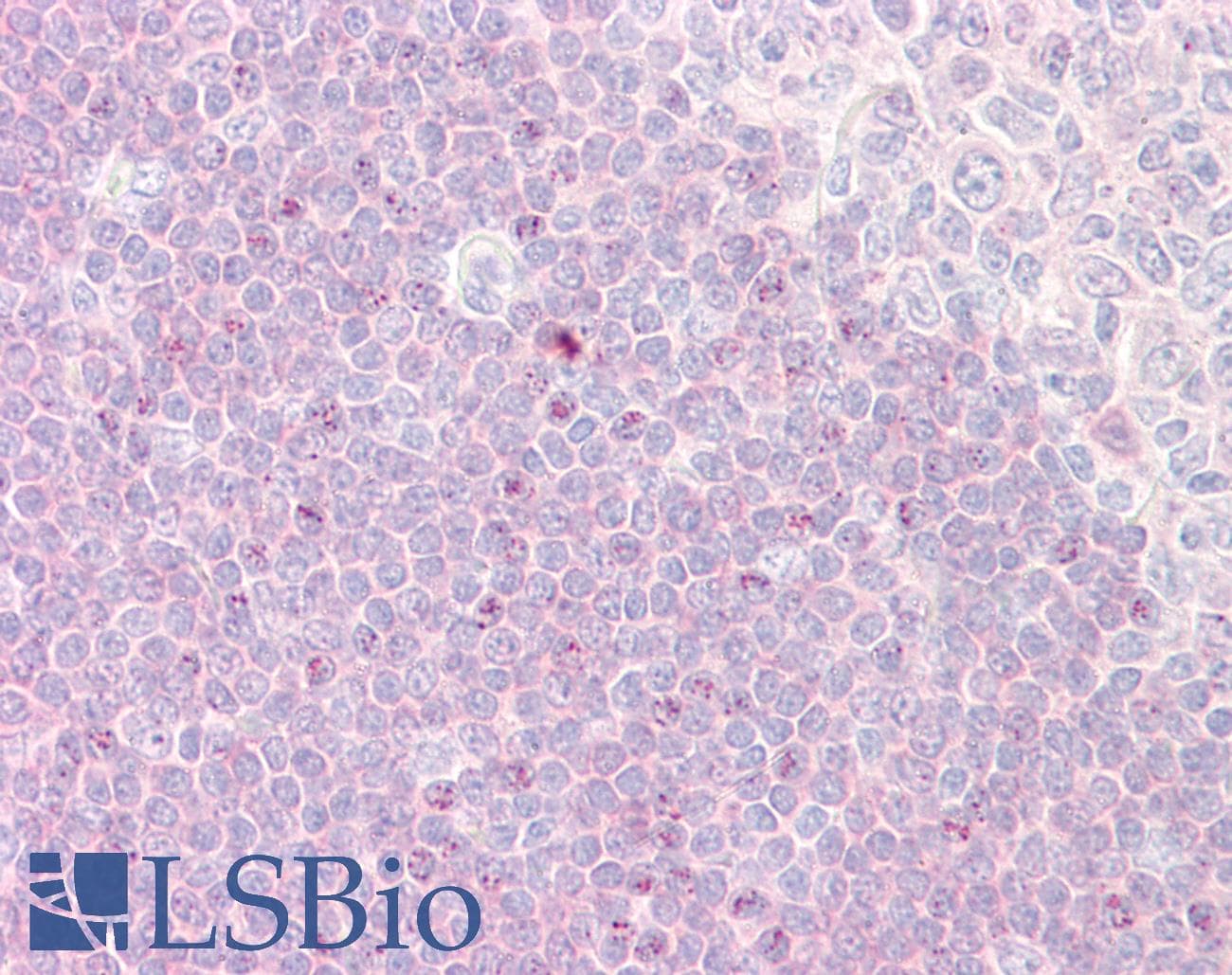 IHC-plus™ RPS6KA1 / RSK1 Antibody (aa346-395)