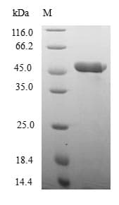Rat NOX4 Protein (Recombinant 6His-B2M, N-terminus)