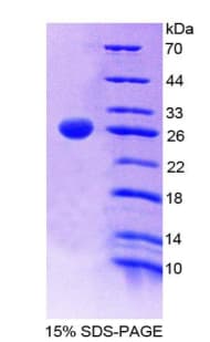Human CD6 Protein (Recombinant His-T7)