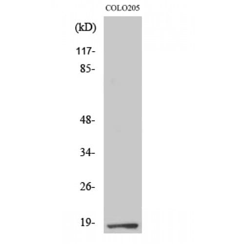Polyclonal Rabbit anti-Human TCEAL1 Antibody (60-140 aa, Internal, IHC, WB)