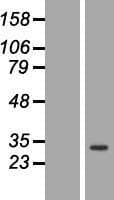 ANP32C Protein (Over-Expression Lysate Myc-DDK (Flag))