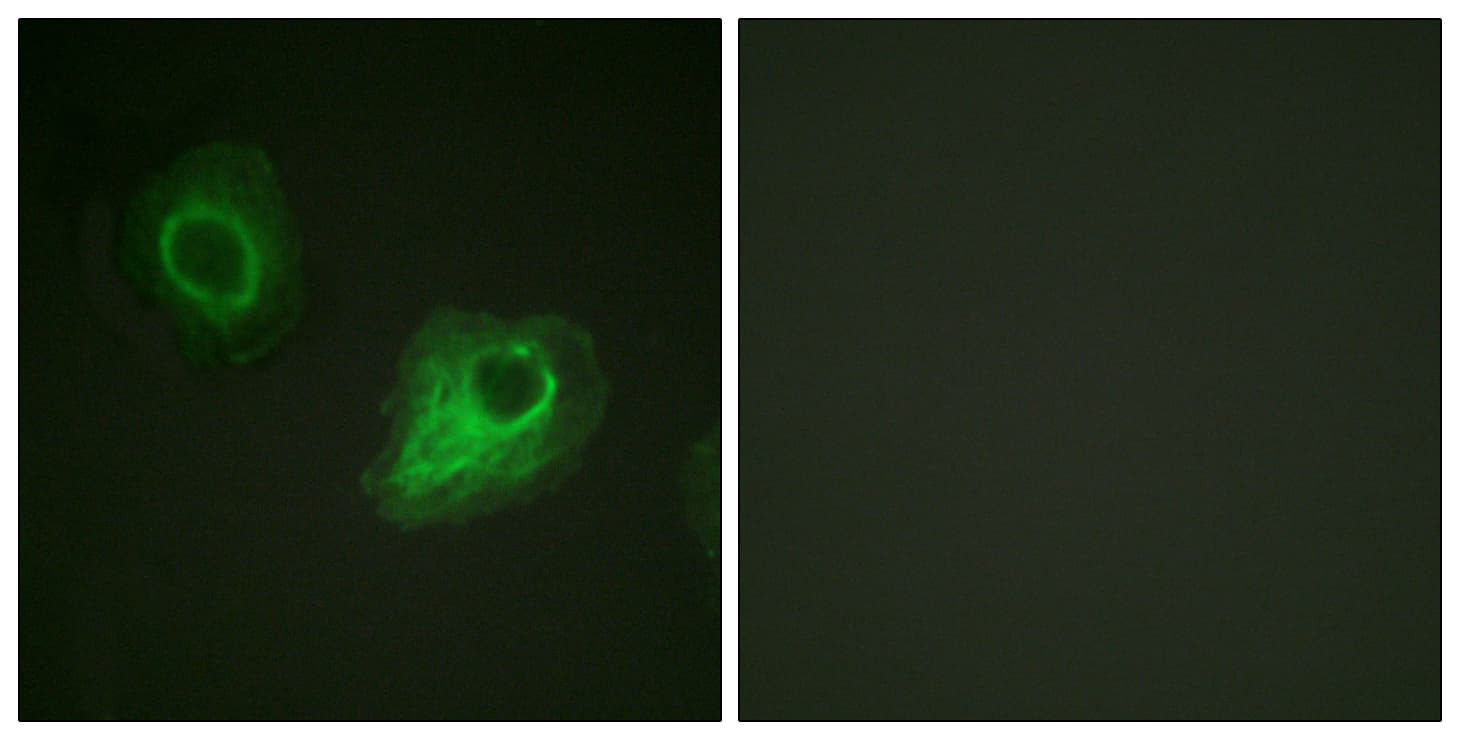 KDR / VEGFR2 / FLK1 Antibody (aa1020-1069)