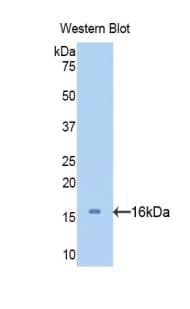 SERPINA6 / CBG Antibody (aa280-405)