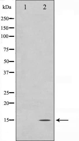 Polyclonal Rabbit anti-Human MLANA / Melan-A Antibody (IHC, IF, WB)