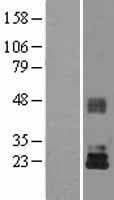 Human TIMP3 Protein (Over-Expression Lysate Myc-DDK (Flag))