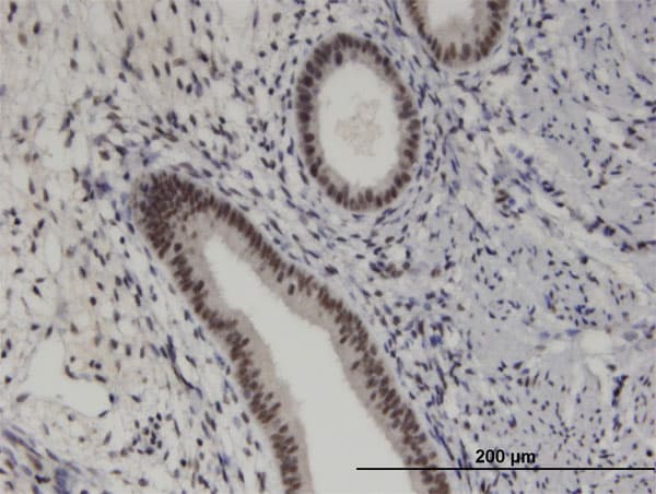 PRKRIP1 Antibody (clone M2)