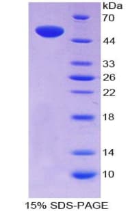 Rat NPR3 Protein (Recombinant His-T7)