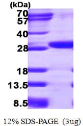 Human ETHE1 Protein (Recombinant His)