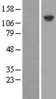 INPP5D / SHIP1 / SHIP Protein (Over-Expression Lysate Myc-DDK (Flag))