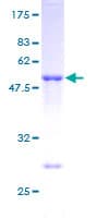 Human TIA-1 Protein (Recombinant GST)