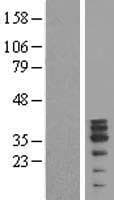 MAGEB10 Protein (Over-Expression Lysate Myc-DDK (Flag))
