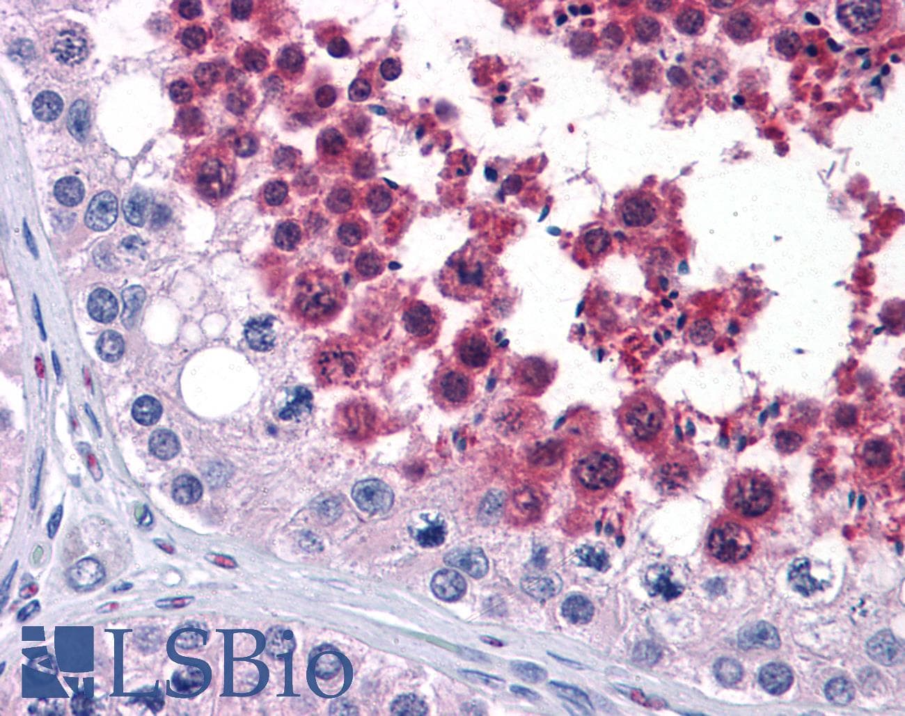 IHC-plus™ CDC25C Antibody (clone 1F12)