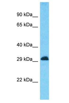 CD81 Antibody (aa170-219)