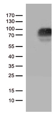 CSF2RA / CD116 Antibody (aa23-320, clone OTI2E12)