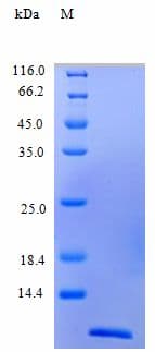 Human CCL2 / MCP1 Protein (Recombinant)