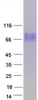 Human IL7R / CD127 Protein (Recombinant Myc-DDK (Flag))