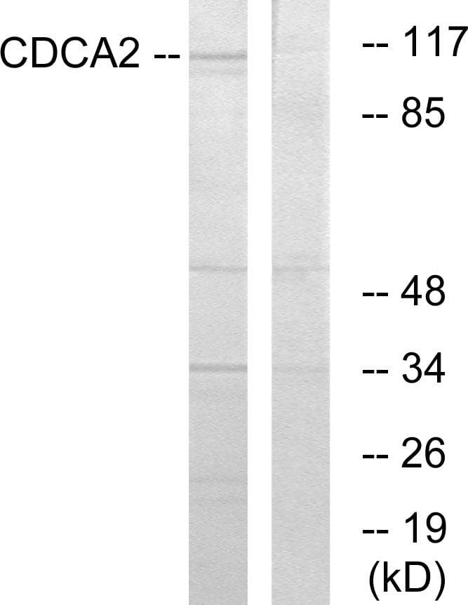 CDCA2 Antibody