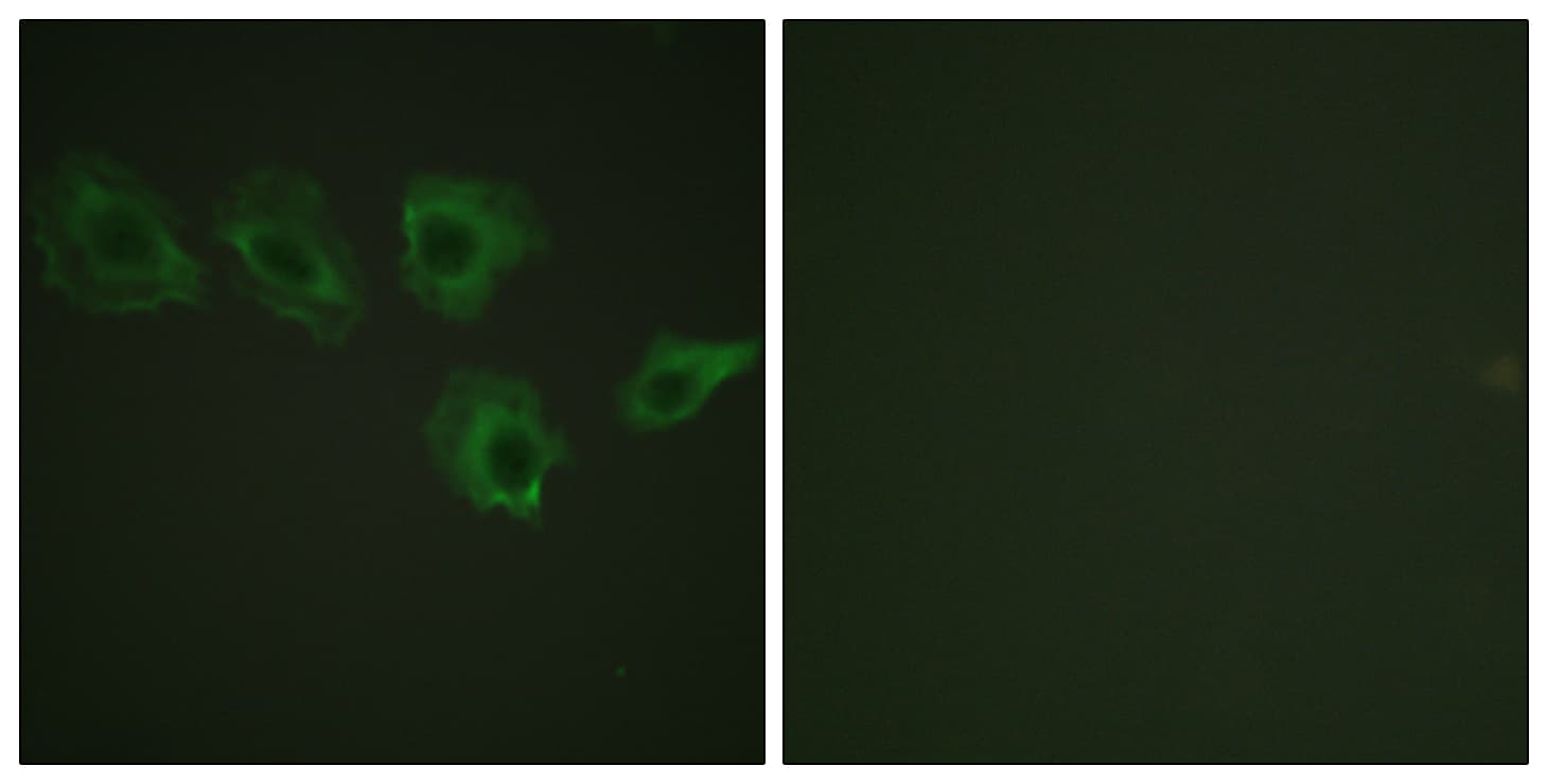 PPP1R12A / MYPT1 Antibody (phospho-Thr696)