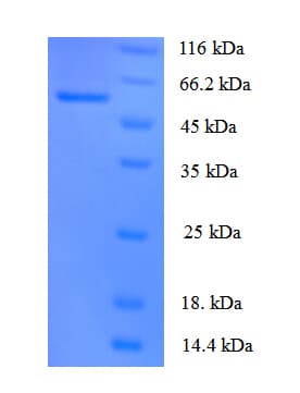 Human ANGPT1 / Angiopoietin-1 Protein (Recombinant His)