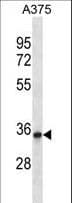 PPP1R27 / DYSFIP1 Antibody (aa1-30)
