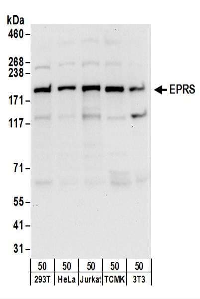 EPRS / PARS Antibody (aa950-1000)
