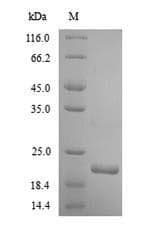 Human ITGA2 / CD49b Protein (Recombinant 6His, N-terminus)