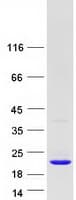 Human UBE2I / UBC9 Protein (Recombinant Myc-DDK (Flag))